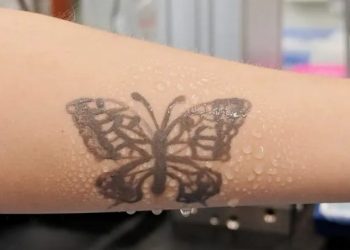 Ky “tatuazh elektronik” mund të paralajmërojë pacientët për probleme të mundshme shëndetësore