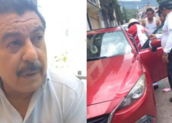 Rrihet brutalisht gazetari shqiptar, goditet me shufra hekuri në fytyrë (FOTO)