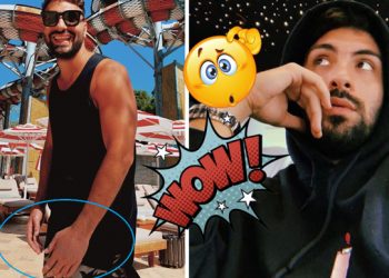 Pasi u vendos në qendër të vëmendjes për “Vitiligo”, Ledri Vula jep mesazhin e bukur