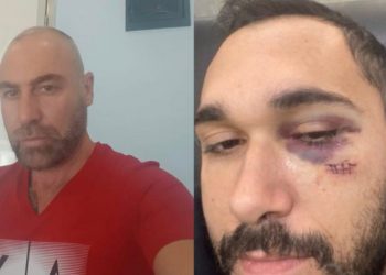 “Më ka kërcënuar”/ E tradhtoi me drejtorin e doganve në Fier, çifti përballet live në studio