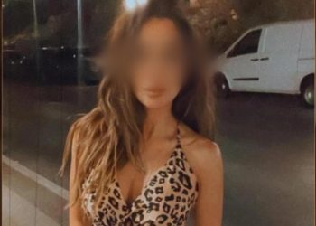 “E pamëshirshme”/ Gruaja i hedh burrit acid në fytyrë teksa ishte duke fjetur