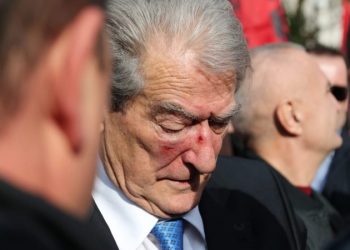 Pse do ju bënte Rama atentat? Berisha: S’e kontrollon dot veten