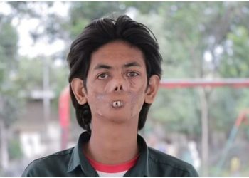 Njerëzit frikësohen nga unë –