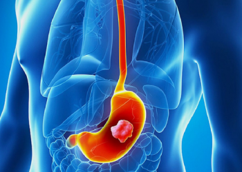 Çfarë tregojnë problemet me stomakun për shëndeti tuaj –