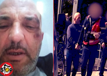 Policia e Lezhës arreston dhe keqtrajton qytetarin, i nxin sytë –