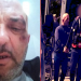 Policia e Lezhës arreston dhe keqtrajton qytetarin, i nxin sytë –