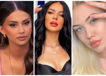 Big “Botox” VIP, ja vajzat që i ka zbukuruar kirurgu –