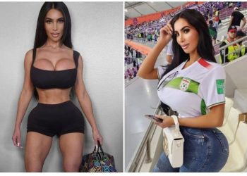 Vdes gjatë operacionit plastik sozia e Kim Kardashian –
