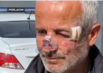 Dhuna barbare ndaj punonjësit të Bashkisë Patos, reagon policia –