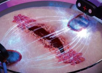 Elektriciteti mund t’i shërojë plagët 3 herë më shpejt –