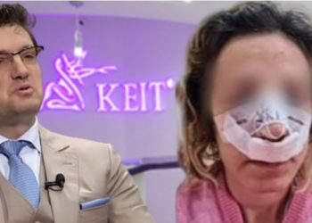 Bëri operacion te klinika Kei, 27-vjeçarja probleme me frymëmarrjen –