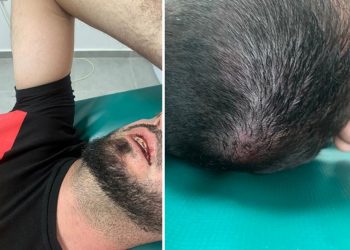 Gjakoset aktivisti i PD në Fushë Arëz –