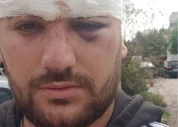 Sherr në Kishën e Laçit, rojet private përplasen me shitësit ambulantët –