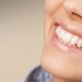 Dëmtimi i dhëmbëve? Ja çfarë duhet të bëjmë për ta shmangur –