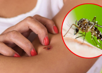 Po hasni vështirësi me mushkonjat? Ja si të shpëtoni prej tyre –