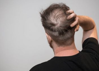 Ja disa udhëzime për të evituar rënien e flokëve –