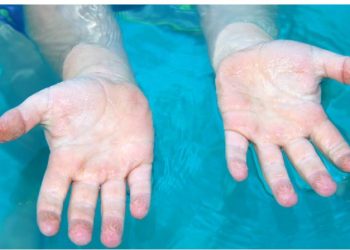 Pse rrudhen gishtat në ujë? –