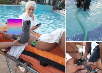 FOTO/ Fëmijës i ngeci dora te tubi pishinës, ndërhyjnë zjarrfikësit –