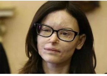 I hodhi acid në fytyrë avokates italiane, shqiptari del nga burgu pas 9 vitesh –