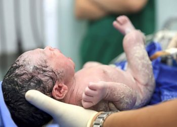 Të lindësh me “këmishë”, mjeku ndan pamjet nga fenomeni i rrallë në Tiranë (VIDEO) –