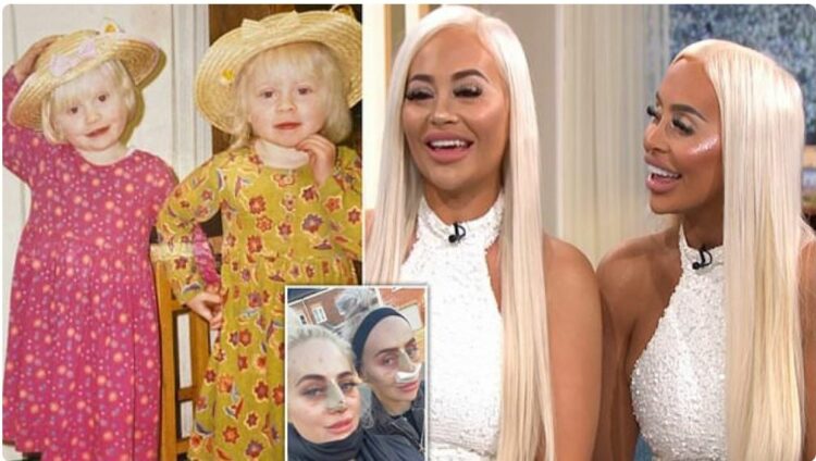 Binjaket shpenzojnë 186 mijë euro për t’u dukur si Barbie –