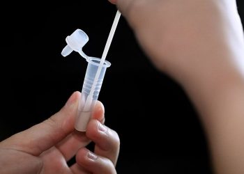 Rikthehet virusi i rrezikshëm në Greqi –