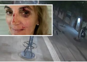 Një mjeke sulmohet në rrugë, policia publikon pamjet –