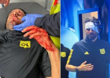 Nëntë të arrestuar për sulmin ndaj trajnerit të Lionit në Marsejë –