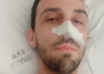 Joan Nuni Nasto ka nevojë më shumë se kurrë për ndihmën e shqiptarëve –
