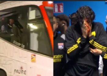 Tifozët godasin me gurë trajnerin –