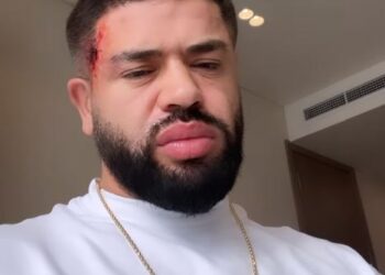 Sherr apo…, Noizy shfaqet i gjakosur (VIDEO) –