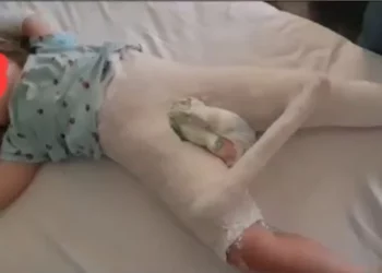 Tiranë/ Edukatorja i thyen këmbën fëmijës 3 vjeç, manipulohet ngjarja –