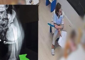 Dhunimi i 3-vjeçares në kopsht, AMP çon në prokurori dy policët –