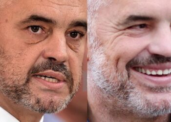 Edi Rama ka bërë ndërhyrje estetike?! Mjekja nxjerr të vërtetën… –