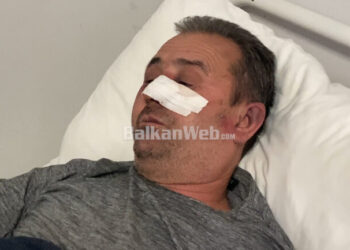 Më goditën me qytën e armës –