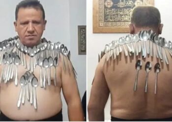 Një iranian thyen rekordin, vendos 88 lugë të balancuara në trup –