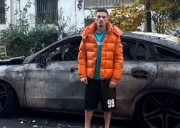 Nuk është hera e parë, digjet makina e personazhit të njohur në… –