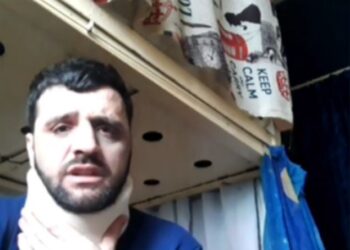 E dhunuan në burgun famëkeq grek, ja çfarë thotë shqiptari nga qelia –