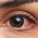 Çfarë e përcakton ngjyrën e syve, a mund të ndryshojë ajo…? –