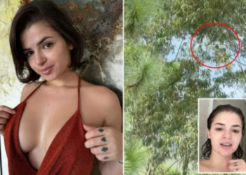 Modelja tregon momentet e frikshme kur…