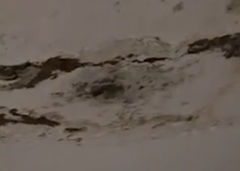 Skandal në Maternitetin e Lushjes/ Muret dhe tavani, të mbuluara nga myku dhe lagështia –