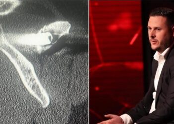 “Kam 27 vite me plumb në trup”- I mbijetuari i masakrës së Suharekës rrëfen tmerrin nga serbët –