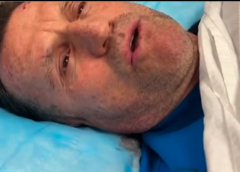 Njëri po ofendonte, tjetri më goditi pas koke me mjet prerës –