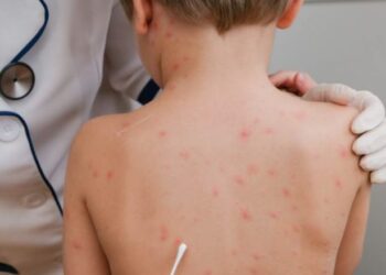 Çfarë ndodh nëse pacienti ka ndërlikime –