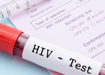 Shqipëria përballë një vale të re infeksionesh, rekord që nga 2016-a –